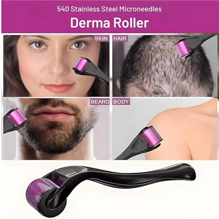 derma-roller-for-hair3.jpg